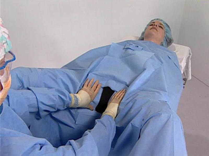 Drape Lithotomy Laparoscopy